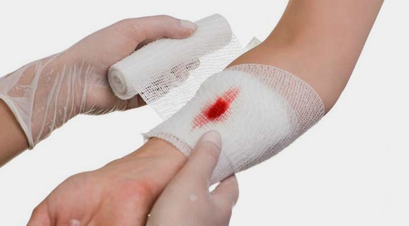 7 mẹo chăm sóc vết thương hở hiệu quả tại nhà